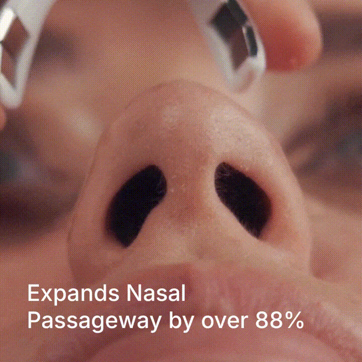 NasalFix, Dilatador Nasal Magnético – Respira Mejor al Instante