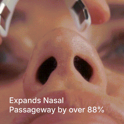 NasalFix, Dilatador Nasal Magnético – Respira Mejor al Instante